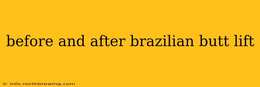before and after brazilian butt lift