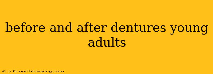 before and after dentures young adults