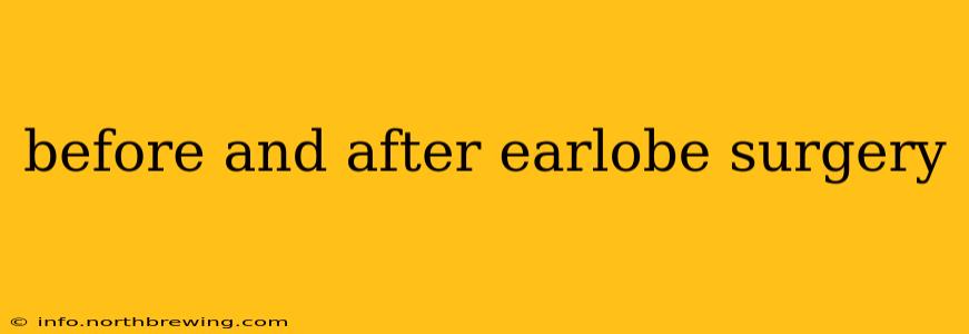 before and after earlobe surgery
