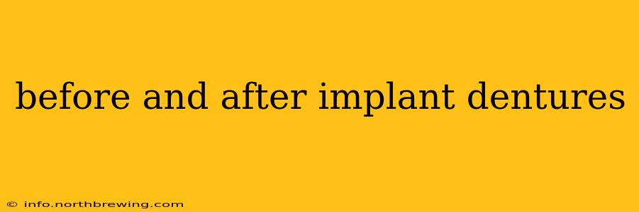 before and after implant dentures