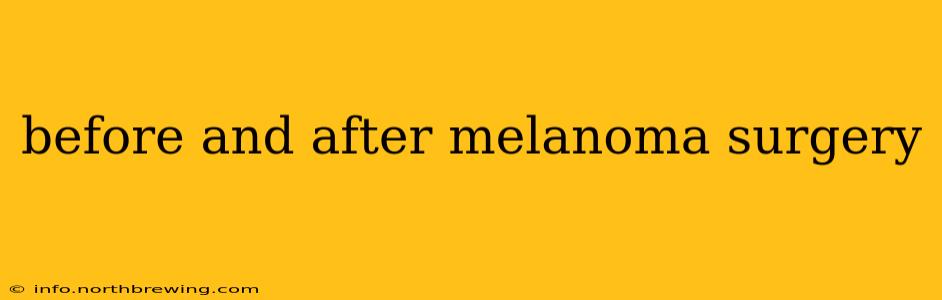 before and after melanoma surgery