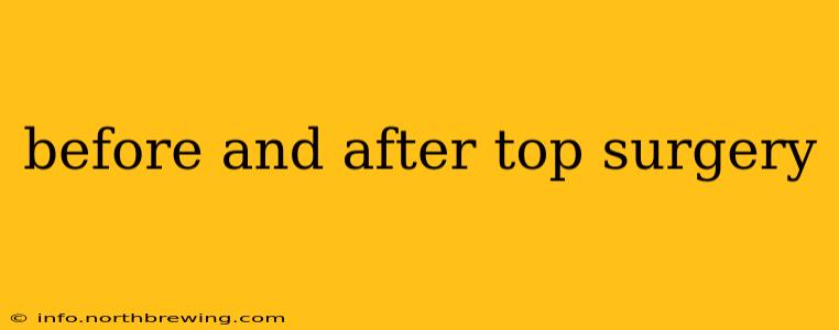 before and after top surgery