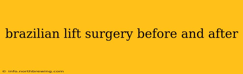 brazilian lift surgery before and after