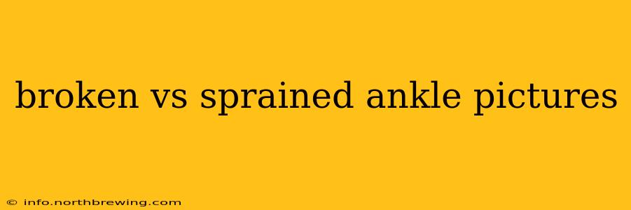 broken vs sprained ankle pictures