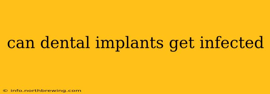 can dental implants get infected