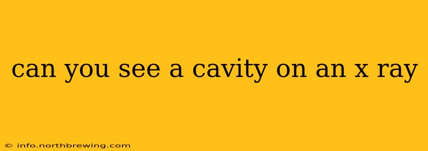 can you see a cavity on an x ray