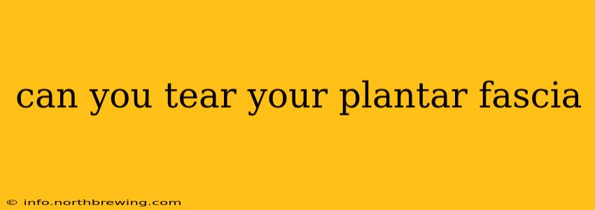 can you tear your plantar fascia