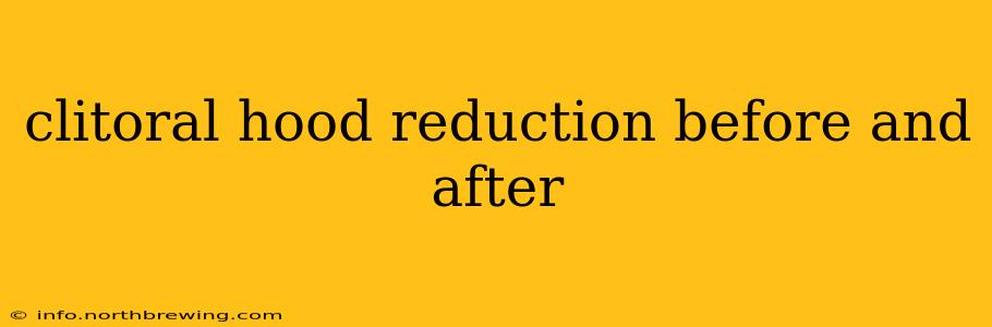 clitoral hood reduction before and after