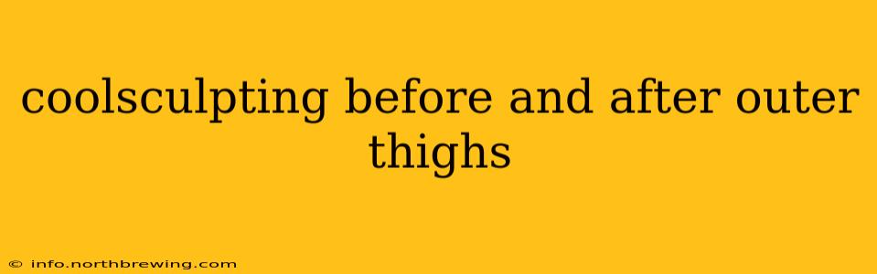 coolsculpting before and after outer thighs