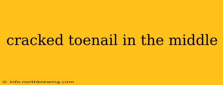cracked toenail in the middle