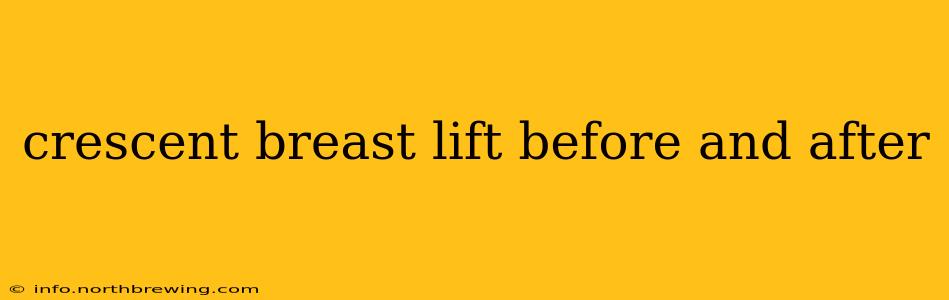 crescent breast lift before and after
