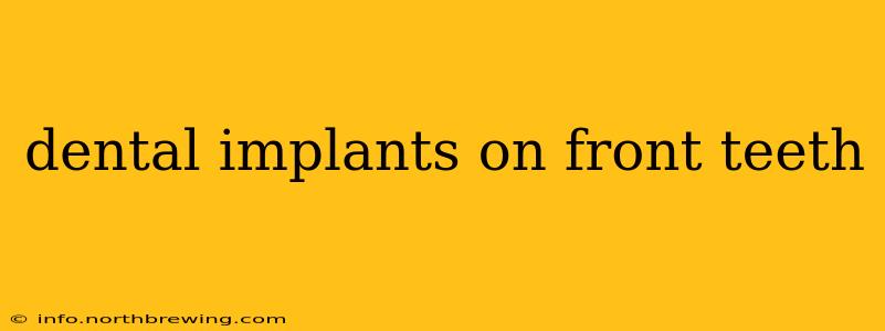 dental implants on front teeth