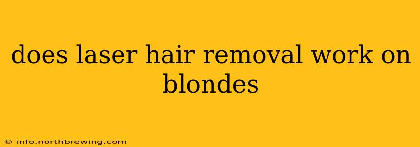 does laser hair removal work on blondes