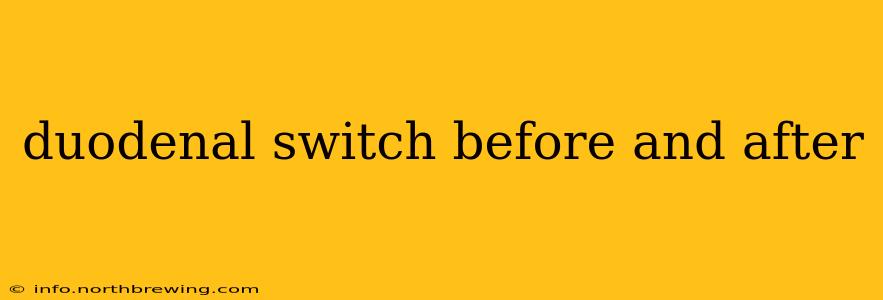 duodenal switch before and after