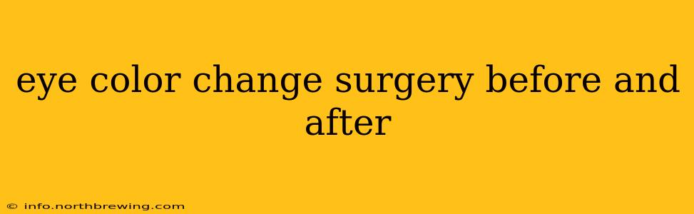 eye color change surgery before and after