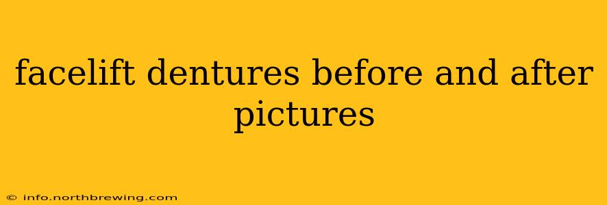 facelift dentures before and after pictures