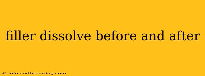 filler dissolve before and after