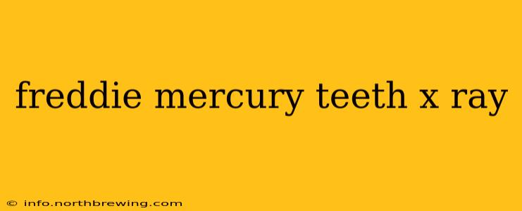 freddie mercury teeth x ray