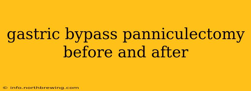 gastric bypass panniculectomy before and after