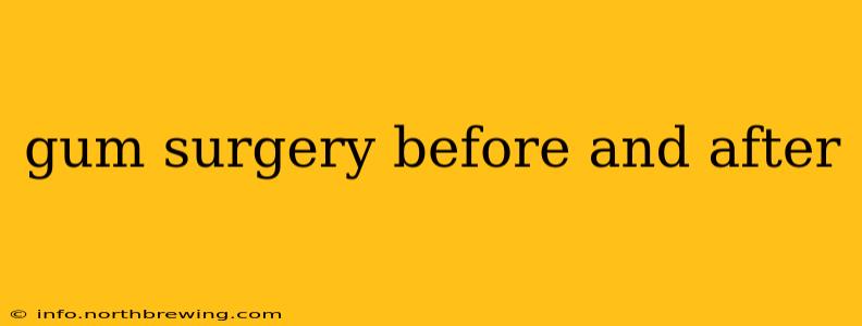gum surgery before and after