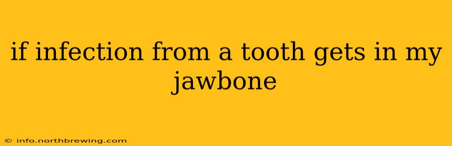 if infection from a tooth gets in my jawbone