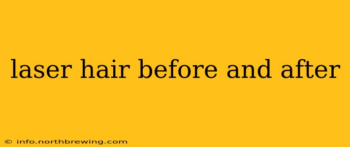 laser hair before and after