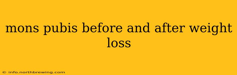 mons pubis before and after weight loss
