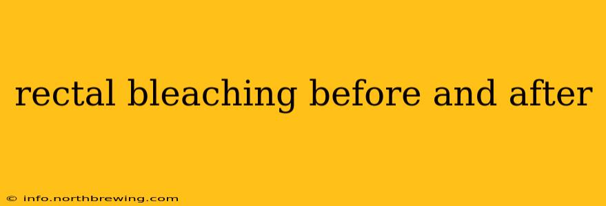 rectal bleaching before and after