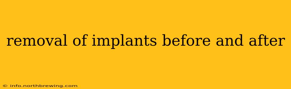 removal of implants before and after