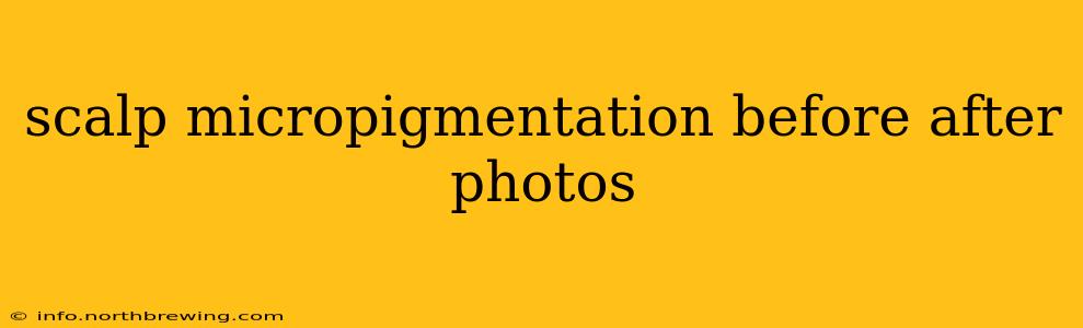 scalp micropigmentation before after photos