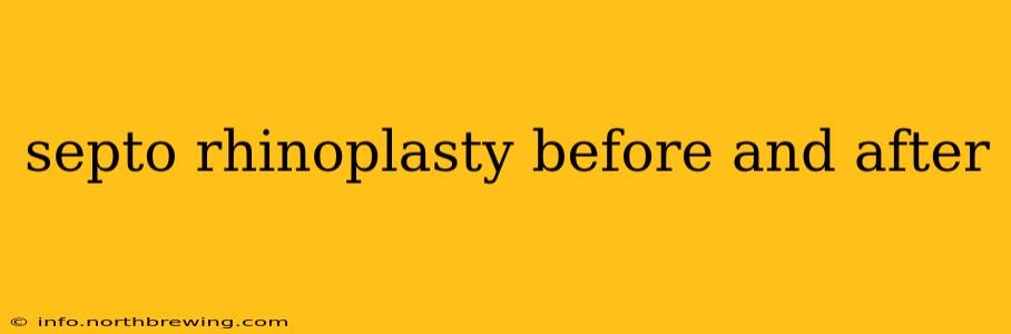 septo rhinoplasty before and after