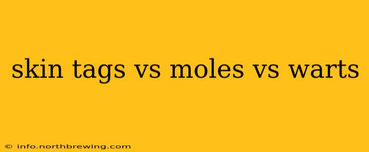 skin tags vs moles vs warts