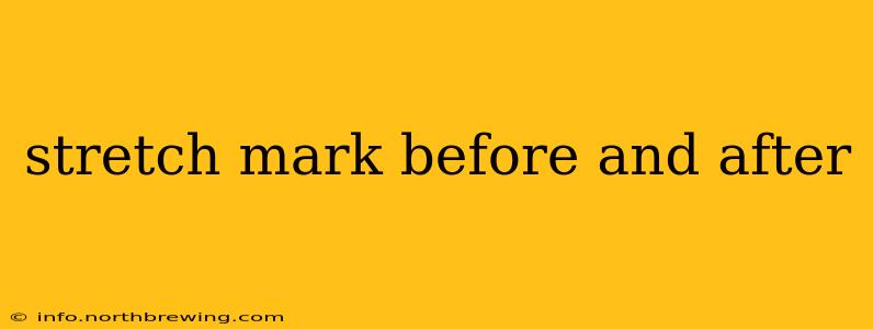 stretch mark before and after