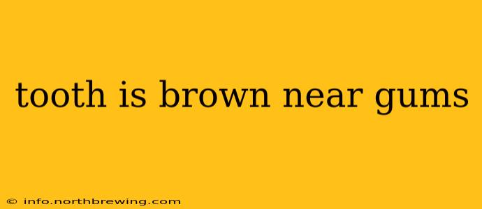tooth is brown near gums