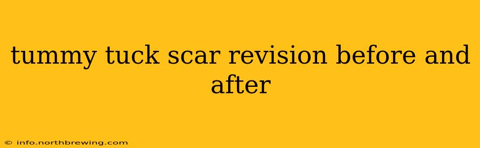 tummy tuck scar revision before and after