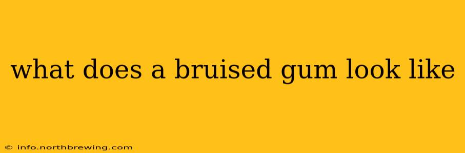 what does a bruised gum look like