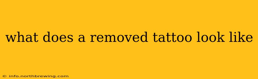 what does a removed tattoo look like