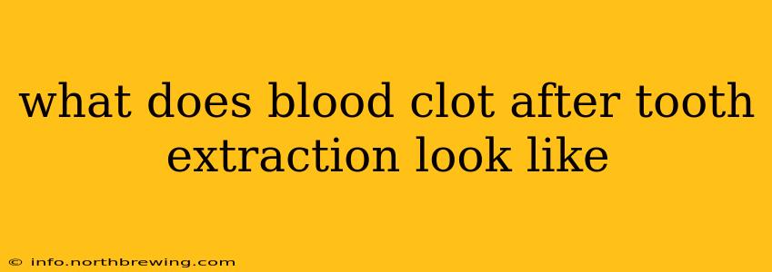 what does blood clot after tooth extraction look like