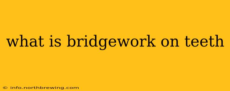 what is bridgework on teeth