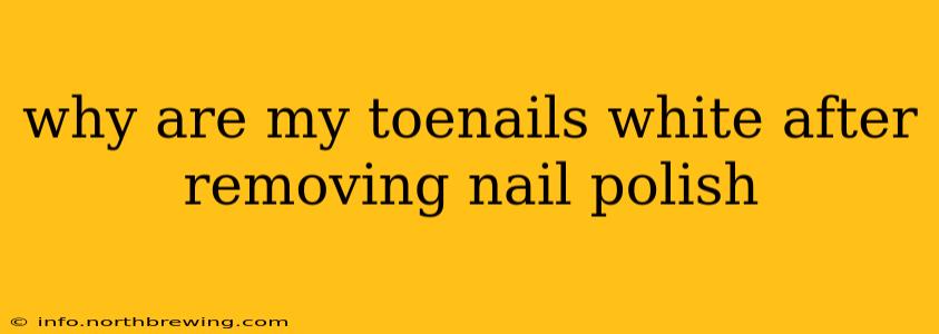 why are my toenails white after removing nail polish