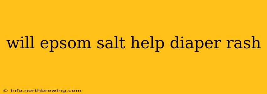 will epsom salt help diaper rash