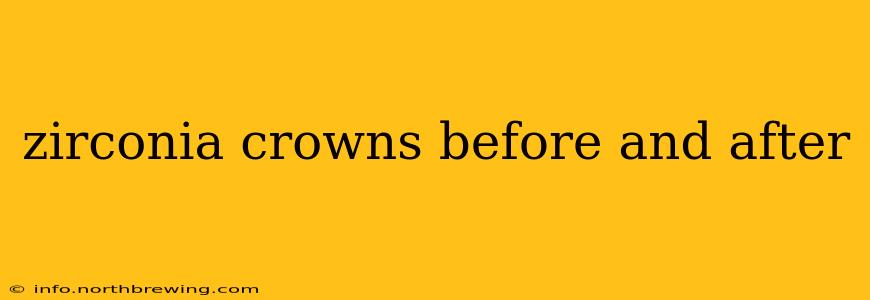 zirconia crowns before and after